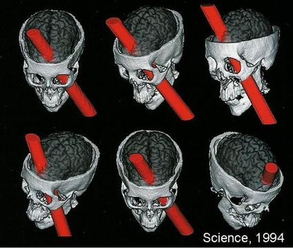 phineas gage case study ib psychology